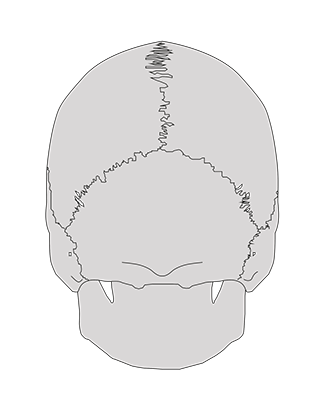 Alignement du crâne, de l'atlas et de l'axis. Les condyles occipitaux reposent sur les surfaces articulaires de l'atlas.