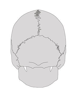 Alignement du crâne, de l'atlas et de l'axis. Les condyles occipitaux reposent sur les surfaces articulaires de l'atlas.